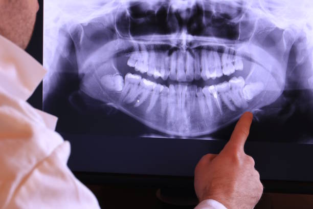Emergency Dentist Open Today in GA