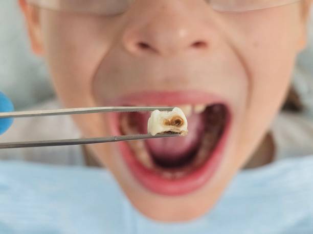 Best Dentist for Dental Trauma  in Shannon, GA